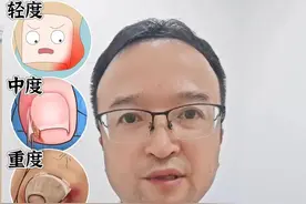 甲沟炎应该怎么办？#甲沟炎#嵌甲 #医学科普#科普视频封面
