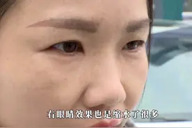 #女子五千元割双眼皮两个月恢复如初 记者出击为女子讨公道，整形机构负责人为何暴怒：我要报警！视频封面