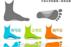 常见足部问题#扁平足 #高弓足#x型腿 #o型腿视频封面