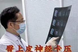 此患者腰腿疼有一年余，腰椎CT提示有轻微膨出，，经查体主要问题还是臀上皮神经卡压，引起腰腿痛，日常应尽量穿着宽松裤子，少穿牛仔裤#腰痛 #腿痛 #臀上皮神经卡压 #疼痛科 #视频仅供参考如有不适请线下就医视频封面