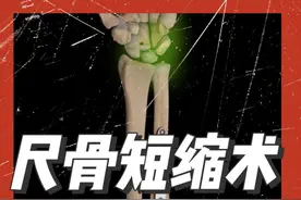10秒学会尺骨短缩术，治疗尺骨撞击综合征#医学科普 #微创手术 #运动康复#尺骨撞击综合征  #上热门视频封面