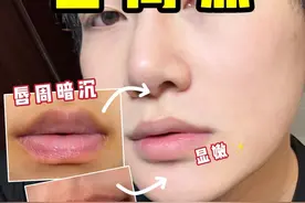 3个0成本改善唇周黑的小技巧，5分钟讲清楚 唇周黑怎么办？唇周暗沉，唇周嫌脏，显嘴凸全在这期#唇周黑 #唇周黑怎么办 #唇周暗沉视频封面