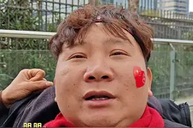 3月15日，杭州刀郎演唱会现场。一位来自江西的刀郎粉丝明明跟记者吐露心声。2013年他意外发生车祸导致左腿截肢全身瘫痪，和妻子离婚后三年不出家门对生活无望。当得知刀郎复出开演唱会后，作为刀粉的明明受到了鼓舞，内心充满了希望和阳光。（记者 李鹏毅）#刀粉心声 #刀郎演唱会视频封面