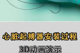 心脏起搏器安装过程#医学科普 #涨知识 #心脏 #手把手让你更健康 视频封面
