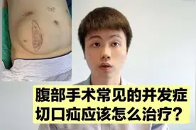 手术后切口部位鼓一个大包？这是切口疝，术后常见并发症视频封面