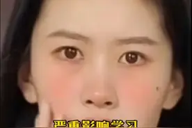 #dou来说健康 #肋骨外翻与正常对比图  #严重影响学习和工作的患者可以关注手术#脸红 #赤面症 #赤面恐惧症视频封面