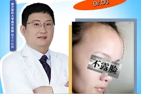 如何改善额骨突出？#额骨突出 #额骨降低 #眉骨降低视频封面