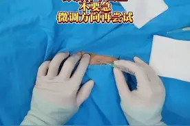 今天这个穿刺不够丝滑 一针穿不中血管不要急，摸清动脉搏动，微调穿刺针，通常都能成功#介入医生的日常 #医生 #日常扎针 #手术视频封面