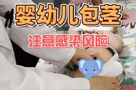 看看你们家宝宝有没有包茎？#生长发育 #发育 #环切术 #复旦儿科儿保彭咏梅 #上海星晨儿童医院视频封面