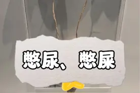 尽量不要憋屎、憋尿#人体结构 #人体奥秘 #科普知识视频封面