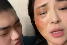 林旭好像一下子懂了生老病死，他怕失去妈妈。怕妈妈变成丑陋的样子，拼命的想办法想让妈妈好起来，急的都要哭了……#自闭症 #林旭同学主要成就视频封面