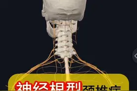 神经根型颈椎病和脊髓型颈椎病！ #神经根型颈椎病 #颈椎病 #脊髓型颈椎病 #硬核健康科普行动 #医疗健康创造训练营视频封面