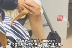 曾在生日当天决定“截肢”的21岁女生饭饭报平安：术后很疼很难受，腿会有幻肢痛，身体各项指标也不太好，抗癌两年发现被误诊。视频封面