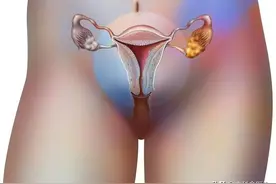 女人要如何保护好子宫？图片