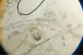 疥螨，它可能是引起狗皮肤问题，最痒的一种寄生虫图片