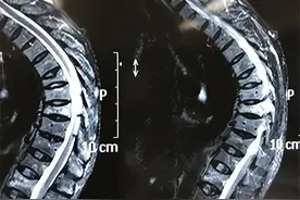 ​65岁阿姨每天在太阳底下“吸阳气”，1年后体检，医生看完都惊讶图片