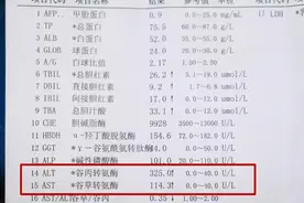 查出转氨酶高怎么办？高到多少才算肝炎？教你看2个数值初步判断图片
