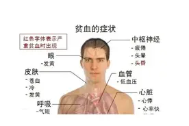 血液报告不为人知的真相 10个早期预警 你会是下一个贫血患者吗？图片