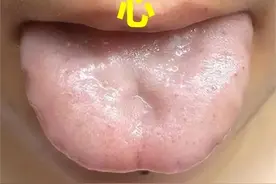 五脏失衡时，各显独特症状，应对有方图片