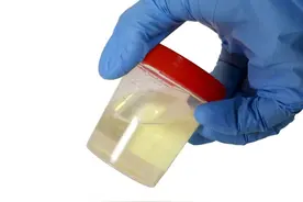 尿常规常见指标的参考值范围及其临床意义？图片