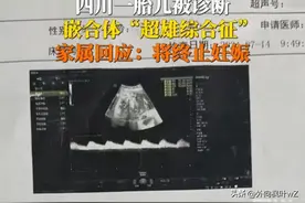 女子大义！四川超雄孕妈同意放弃妊娠，恶魔没有降临于人间！图片