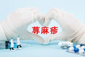 荨麻疹的病因、症状、治疗及预防图片