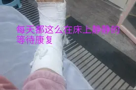 距骨骨折保守治疗的七十六天，不知还需多久才能康复走路，期待中图片