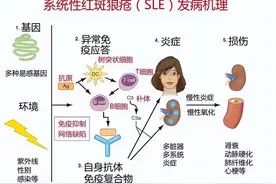 上热搜的“红斑狼疮”，到底是什么病？图片