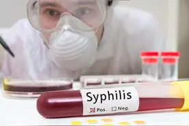梅毒为何能伪装成各类疾病？它又是怎样阴魂不散的？图片