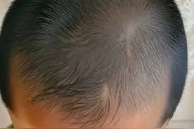 孩子头上有“2个旋”，知道这代表着什么吗？图片