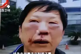 2015年小伙遛狗不牵绳，打断7旬老人5根肋骨，称：谁让他打我的狗图片