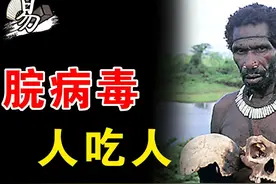 人肉为什么不能吃？同类相食的致死率100%，揭秘朊病毒的真相！图片