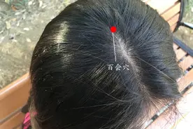 白发多的人3个“黑发穴”了解下！坚持刮一刮，疏通经络乌黑亮发图片