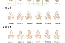 符合顺产的条件图片
