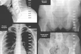 肿瘤医生必看：全身各区域淋巴结 CT 图谱图片