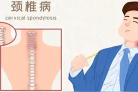 脖子酸、肩膀疼？治疗颈椎病，中医有妙招图片