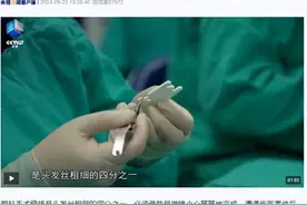 眼科医生陶勇经过一年时间康复训练重新拿起手术刀，社交媒体发文：继续为大家服务图片