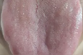 想健脾祛湿，参苓白术散和香砂六君丸哪个更好？中医告诉你！图片