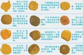 婴儿大便典型颜色性状及身体健康（图解）图片