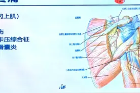肩膀疼痛的原因五花八门图片