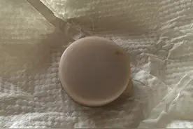 88岁老妈，眉毛上方突然冒出一个粉瘤，还好有祖传药膏帮上忙图片