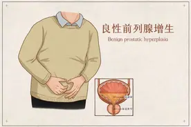 “大夫，我得了前列腺增生，怎么办？” | 科普时间图片