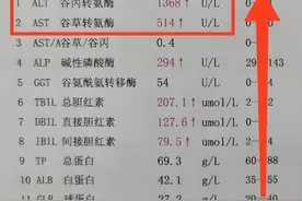 这两个指标异常升高，说明肝脏可能受损了，别不当回事图片