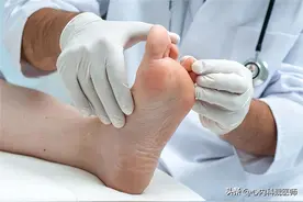 体内有病，“脚底”先知！医生提醒：有这三个特征的人要注意了图片