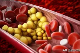 超大规模血脂研究：冠心病患者“低密度”1.45，死亡风险最低！图片