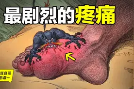 痛风：和生孩子的疼痛机制相同？为什么这是最剧烈的疼痛？图片