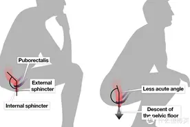 谁也别劝！我就是想把家里的马桶换成蹲便器图片