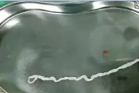 少吃牛蛙！比起寄生虫，更可怕的是这个问题！图片