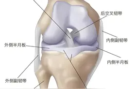 马拉松赛后膝盖“废了”？医生紧急提醒：这3件事千万别做！图片