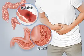 从胃炎到胃癌，大概需要几年？提醒：抓住5个癌变信号，及时刹车图片